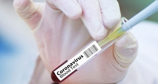 Nowe dane o koronawirusie w gminie - Grodzisk News